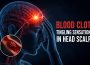 blood clot tingling sensation in head scalp